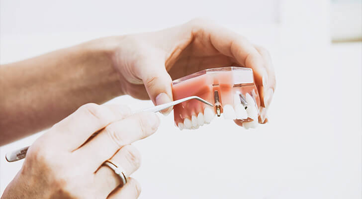 tratamientos-clinica-dental-fuencoro2